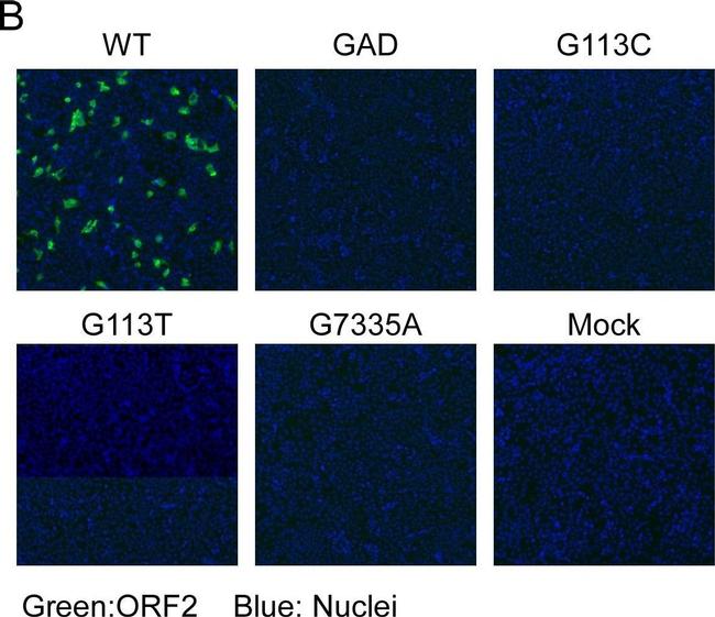 Mouse IgG (H+L) Highly Cross-Adsorbed Secondary Antibody in Immunocytochemistry (ICC/IF)