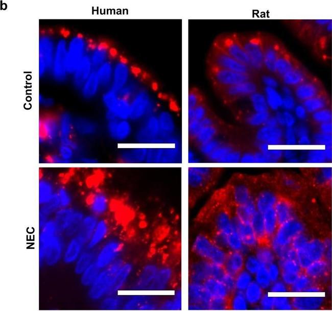 Mouse IgG (H+L) Highly Cross-Adsorbed Secondary Antibody in Immunocytochemistry (ICC/IF)