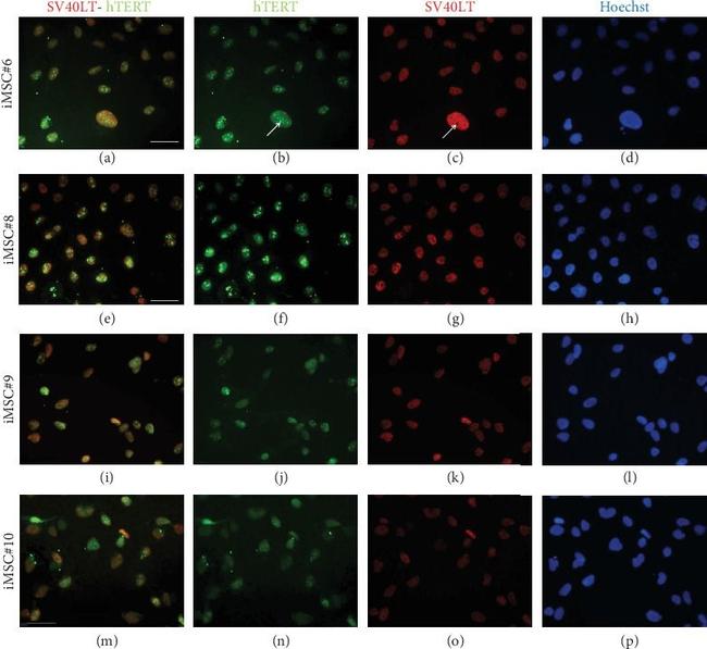 Mouse IgG (H+L) Highly Cross-Adsorbed Secondary Antibody in Immunocytochemistry (ICC/IF)