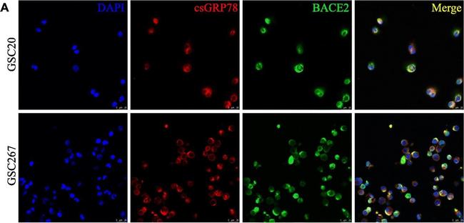 Mouse IgG (H+L) Highly Cross-Adsorbed Secondary Antibody in Immunocytochemistry (ICC/IF)