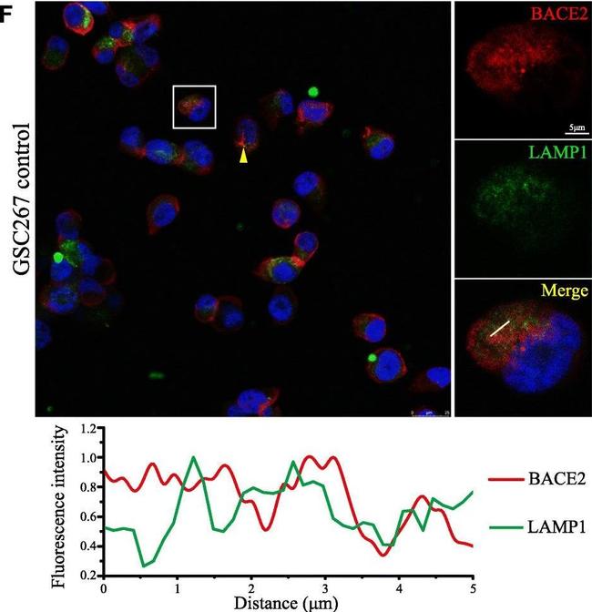 Mouse IgG (H+L) Highly Cross-Adsorbed Secondary Antibody in Immunocytochemistry (ICC/IF)