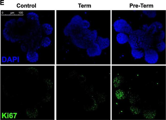 Rabbit IgG (H+L) Highly Cross-Adsorbed Secondary Antibody in Immunocytochemistry (ICC/IF)