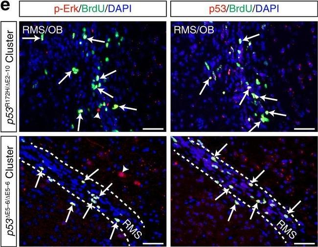 Rabbit IgG (H+L) Highly Cross-Adsorbed Secondary Antibody in Immunohistochemistry (IHC)