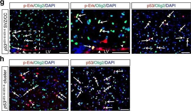 Rabbit IgG (H+L) Highly Cross-Adsorbed Secondary Antibody in Immunohistochemistry (IHC)