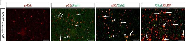 Rabbit IgG (H+L) Highly Cross-Adsorbed Secondary Antibody in Immunohistochemistry (IHC)