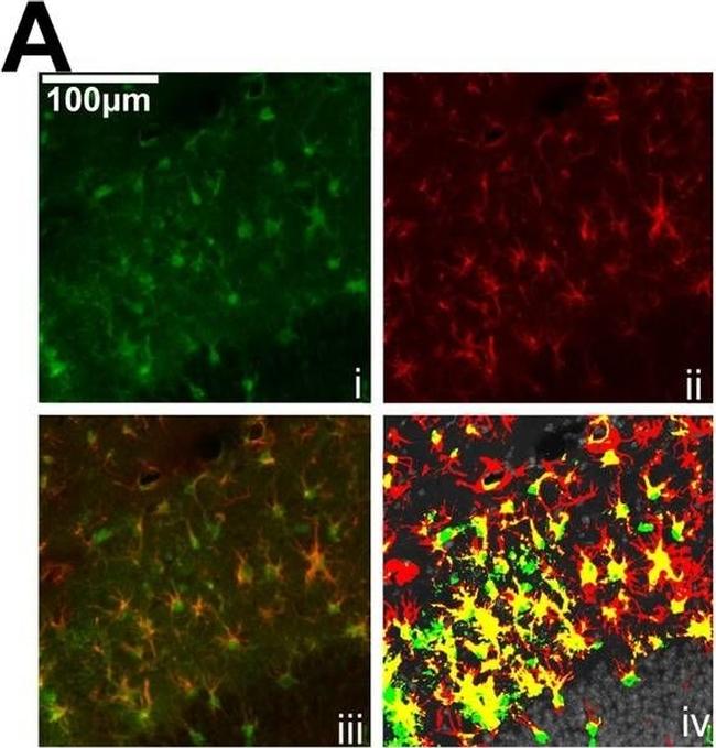 Rabbit IgG (H+L) Highly Cross-Adsorbed Secondary Antibody in Immunocytochemistry (ICC/IF)