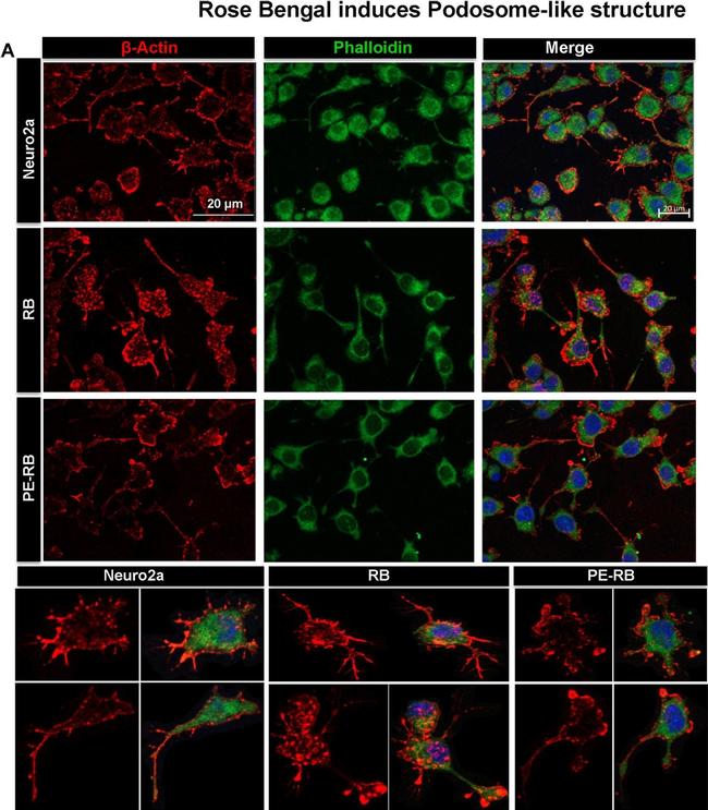 Mouse IgG (H+L) Highly Cross-Adsorbed Secondary Antibody in Immunocytochemistry (ICC/IF)