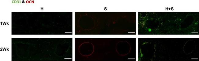 Rabbit IgG (H+L) Highly Cross-Adsorbed Secondary Antibody in Immunocytochemistry (ICC/IF)