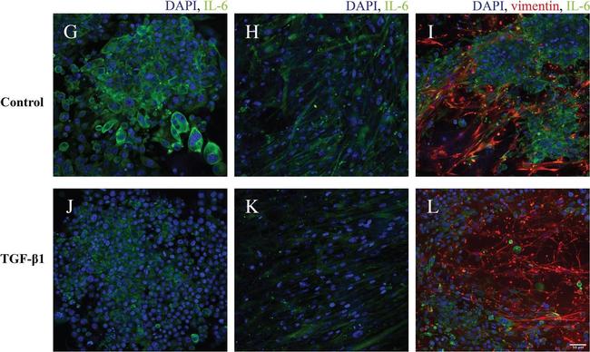 Rabbit IgG (H+L) Highly Cross-Adsorbed Secondary Antibody in Immunocytochemistry (ICC/IF)