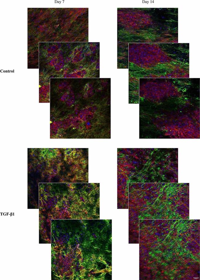 Rabbit IgG (H+L) Highly Cross-Adsorbed Secondary Antibody in Immunocytochemistry (ICC/IF)