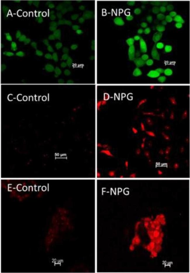 Rabbit IgG (H+L) Highly Cross-Adsorbed Secondary Antibody in Immunocytochemistry (ICC/IF)