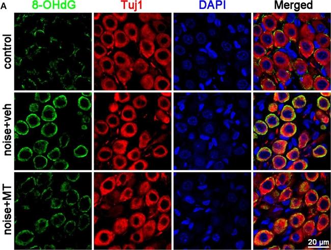 Rabbit IgG (H+L) Highly Cross-Adsorbed Secondary Antibody in Immunohistochemistry (IHC)