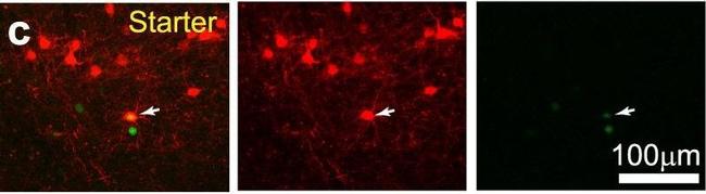 Rabbit IgG (H+L) Highly Cross-Adsorbed Secondary Antibody in Immunohistochemistry (IHC)