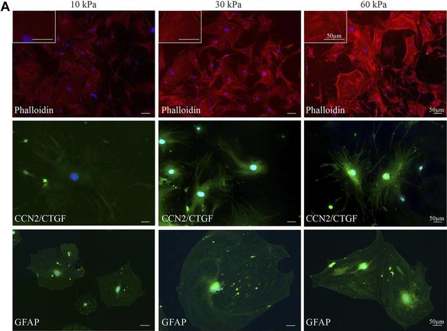 Rabbit IgG (H+L) Highly Cross-Adsorbed Secondary Antibody in Immunocytochemistry (ICC/IF)