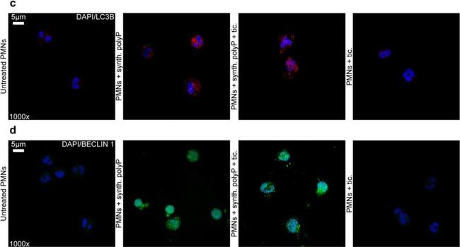 Mouse IgG (H+L) Cross-Adsorbed Secondary Antibody in Immunocytochemistry (ICC/IF)