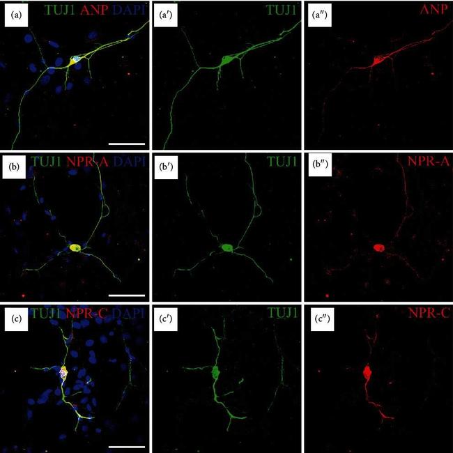 Rabbit IgG (H+L) Highly Cross-Adsorbed Secondary Antibody in Immunohistochemistry (IHC)