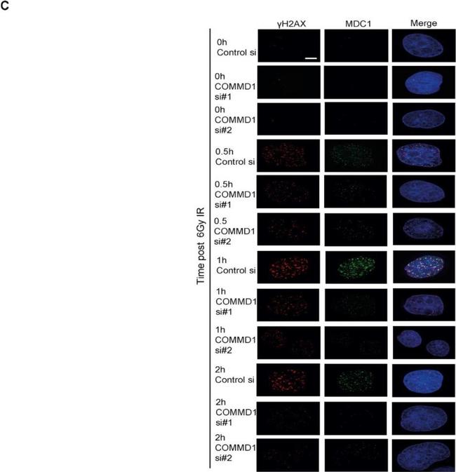 Rabbit IgG (H+L) Highly Cross-Adsorbed Secondary Antibody in Immunocytochemistry (ICC/IF)