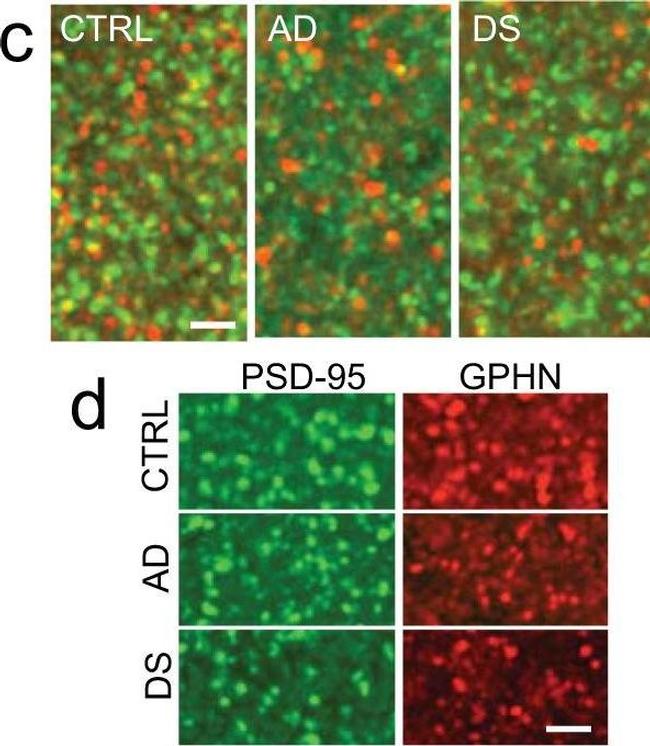 Rabbit IgG (H+L) Highly Cross-Adsorbed Secondary Antibody in Immunohistochemistry (IHC)