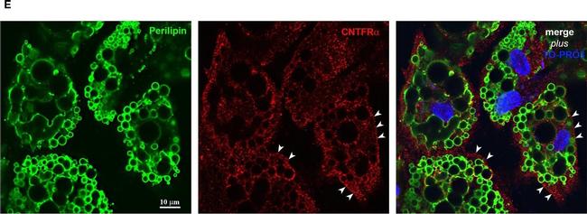 Rabbit IgG (H+L) Highly Cross-Adsorbed Secondary Antibody in Immunocytochemistry (ICC/IF)