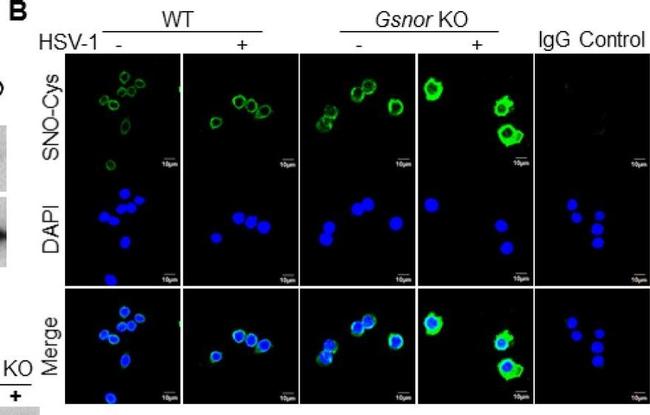 Rabbit IgG (H+L) Highly Cross-Adsorbed Secondary Antibody in Immunocytochemistry (ICC/IF)