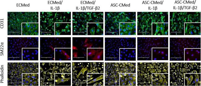 Rabbit IgG (H+L) Highly Cross-Adsorbed Secondary Antibody in Immunocytochemistry (ICC/IF)