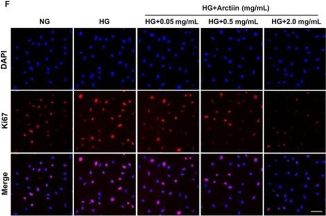 Rabbit IgG (H+L) Highly Cross-Adsorbed Secondary Antibody in Immunocytochemistry (ICC/IF)