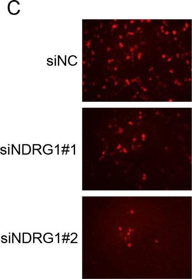 Mouse IgG (H+L) Cross-Adsorbed Secondary Antibody in Immunocytochemistry (ICC/IF)