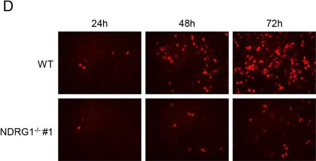 Mouse IgG (H+L) Cross-Adsorbed Secondary Antibody in Immunocytochemistry (ICC/IF)