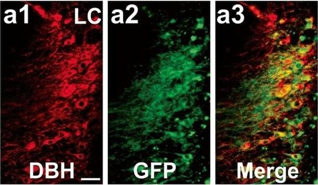 Rabbit IgG (Heavy chain) Secondary Antibody in Immunohistochemistry (IHC)