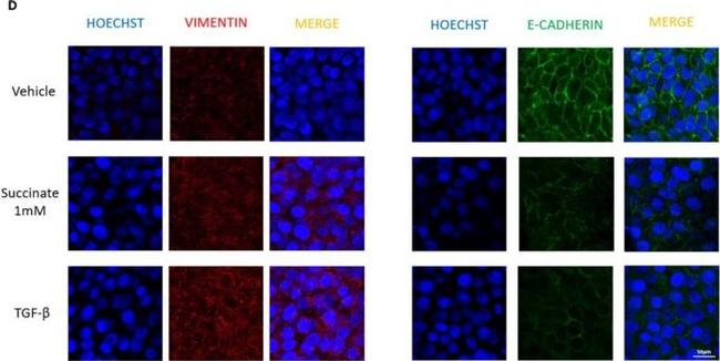 Mouse IgG (H+L) Cross-Adsorbed Secondary Antibody in Immunocytochemistry (ICC/IF)