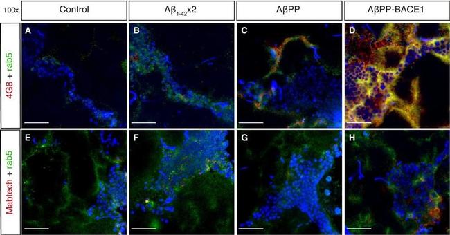 Mouse IgG (H+L) Cross-Adsorbed Secondary Antibody in Immunohistochemistry (PFA fixed) (IHC (PFA))