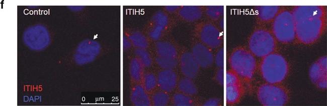 Rabbit IgG (H+L) Cross-Adsorbed Secondary Antibody in Immunocytochemistry (ICC/IF)