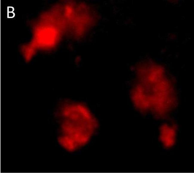 Rabbit IgG (H+L) Cross-Adsorbed Secondary Antibody in Immunohistochemistry (Paraffin) (IHC (P))