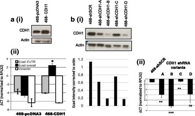 Rabbit IgG (H+L) Secondary Antibody in Western Blot (WB)