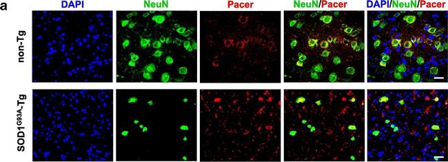 Rabbit IgG (Heavy chain) Secondary Antibody in Immunocytochemistry (ICC/IF)