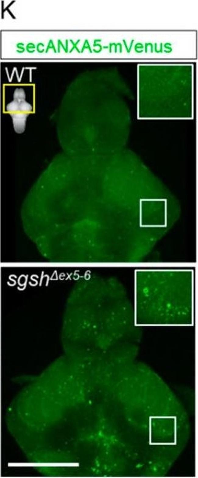 Rabbit IgG (Heavy chain) Secondary Antibody in Immunohistochemistry (IHC)