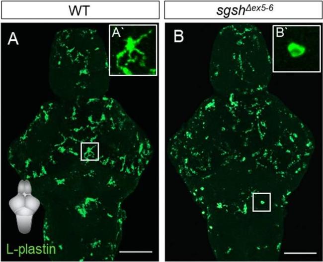 Rabbit IgG (Heavy chain) Secondary Antibody in Immunohistochemistry (IHC)