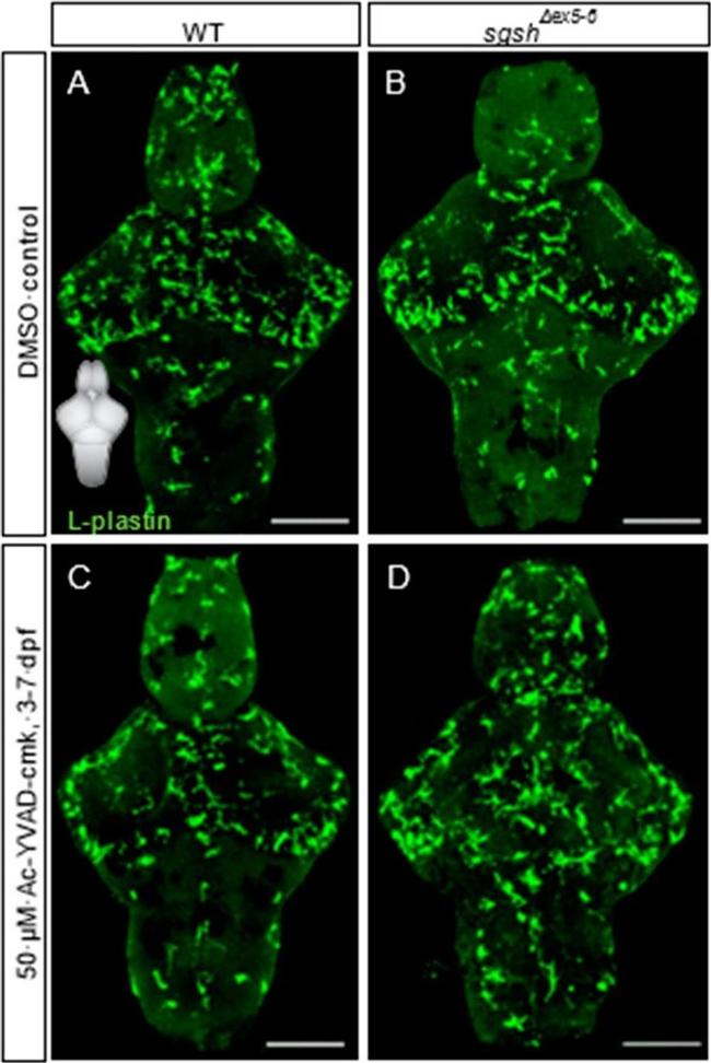 Rabbit IgG (Heavy chain) Secondary Antibody in Immunohistochemistry (IHC)