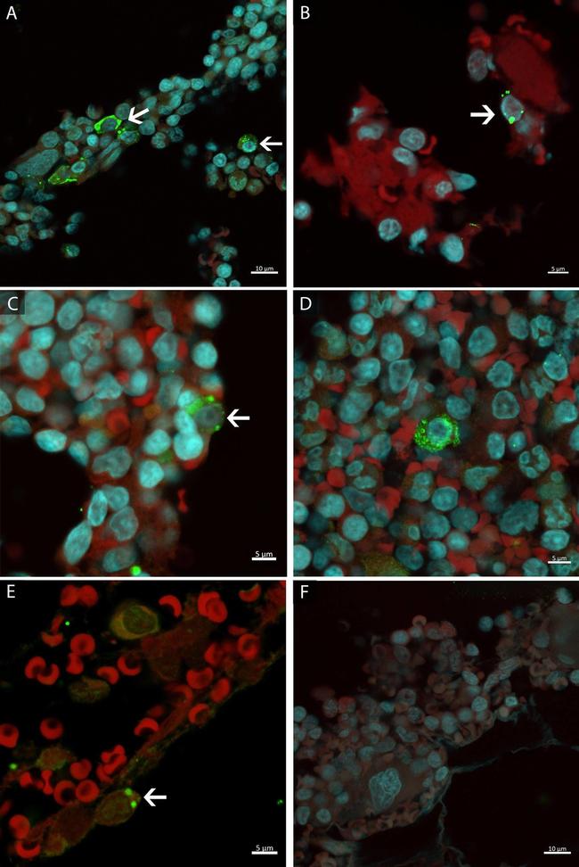 Mouse IgG (H+L) Highly Cross-Adsorbed Secondary Antibody in Immunocytochemistry (ICC/IF)