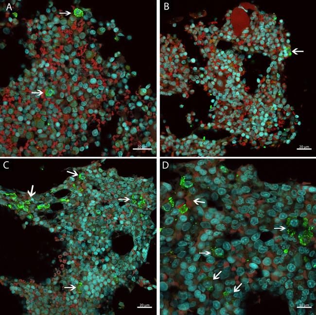 Mouse IgG (H+L) Highly Cross-Adsorbed Secondary Antibody in Immunocytochemistry (ICC/IF)