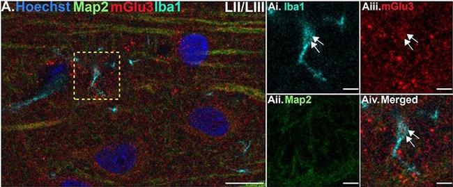 Mouse IgG (H+L) Highly Cross-Adsorbed Secondary Antibody in Immunohistochemistry (IHC)