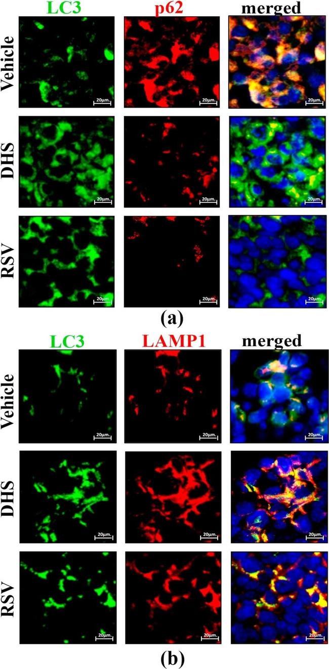 Mouse IgG (H+L) Highly Cross-Adsorbed Secondary Antibody in Immunohistochemistry (IHC)