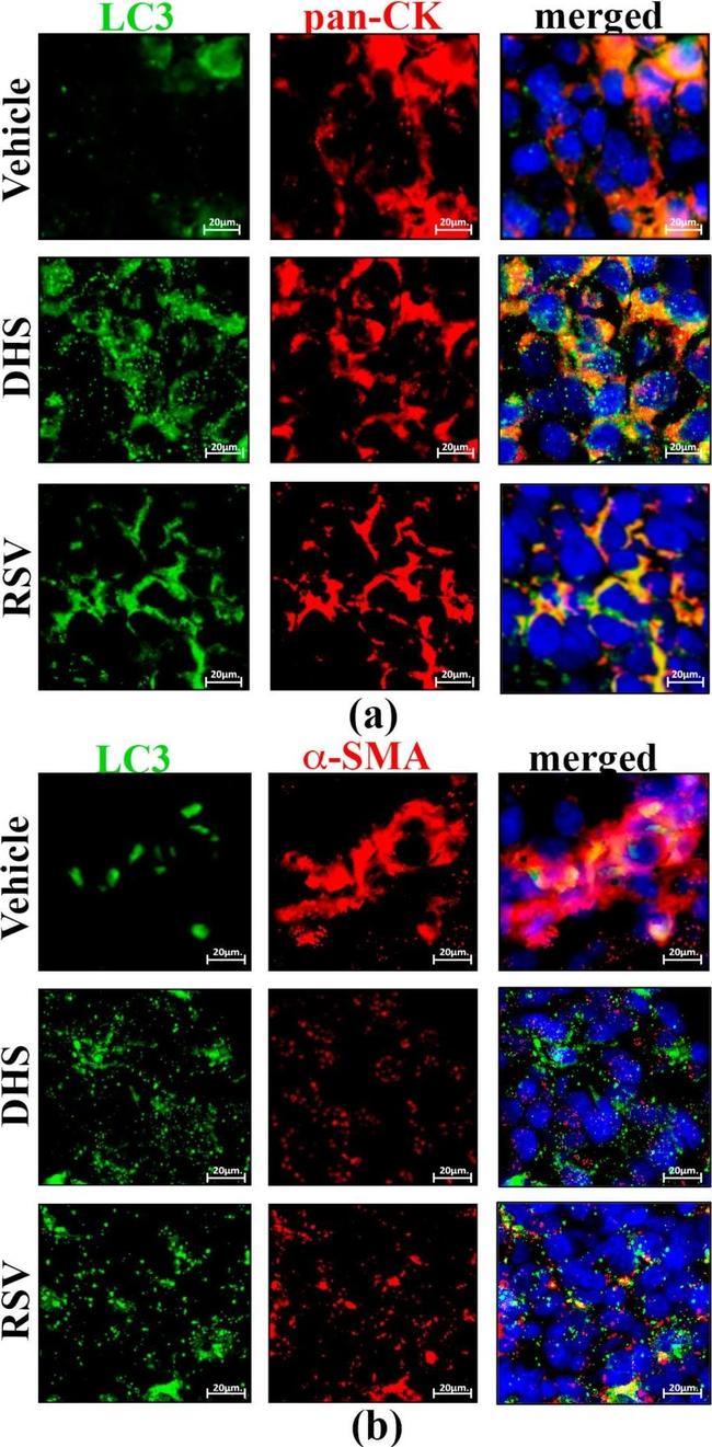 Mouse IgG (H+L) Highly Cross-Adsorbed Secondary Antibody in Immunohistochemistry (IHC)