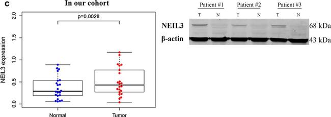 Rabbit IgG (H+L) Highly Cross-Adsorbed Secondary Antibody in Western Blot (WB)