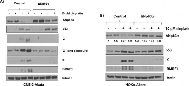 Mouse IgG (H+L) Secondary Antibody in Western Blot (WB)