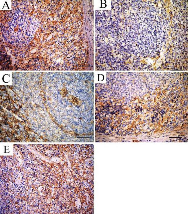 beta Actin Antibody in Immunohistochemistry (IHC)