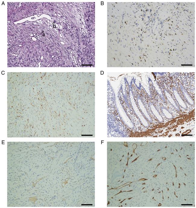 CD34 Antibody in Immunohistochemistry (IHC)