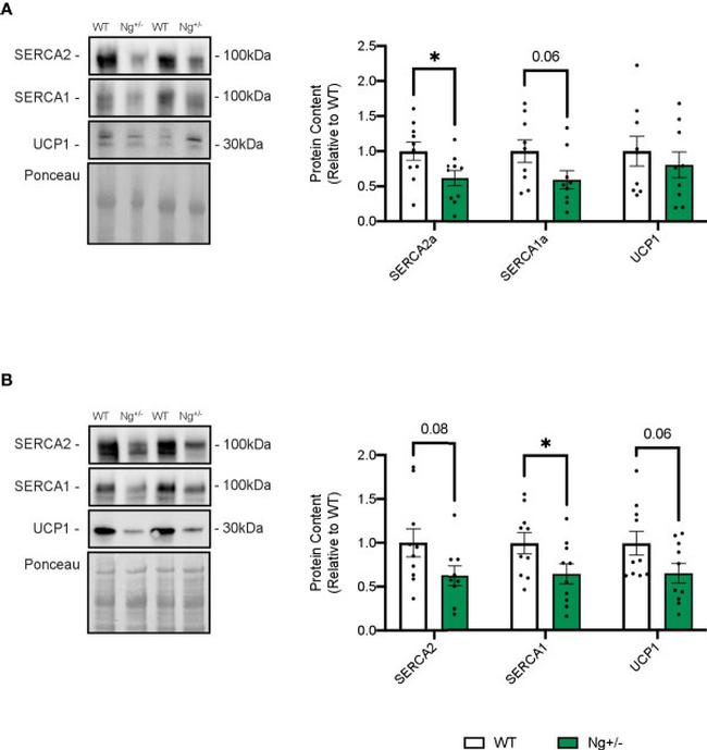 SERCA2 ATPase Antibody in Western Blot (WB)