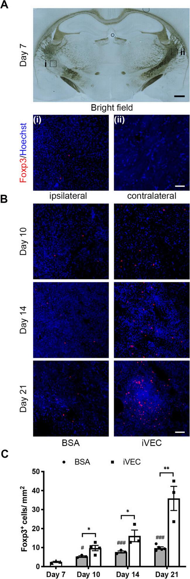 FOXP3 Antibody in Immunocytochemistry, Immunohistochemistry (ICC/IF, IHC)