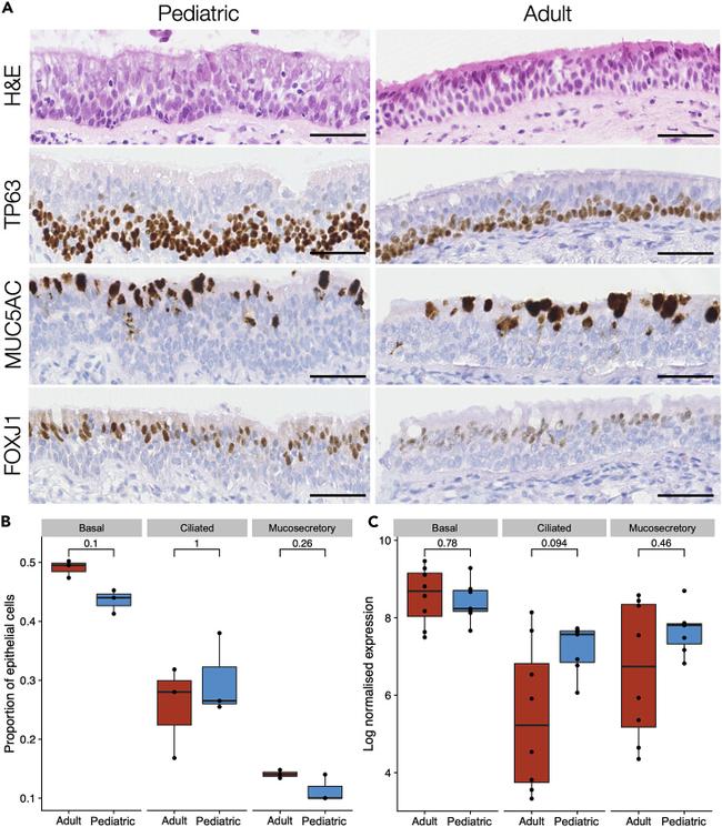 FOXJ1 Antibody in Immunohistochemistry (IHC)